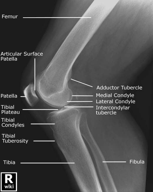 Normal Knee X-rays | Bone and Spine