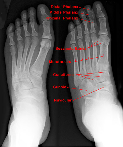 foot bone anatomy xray