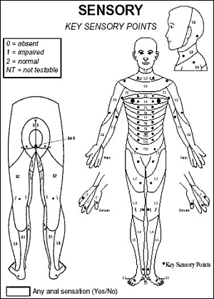 Asia Neurological Chart