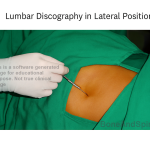 lumbar discography in lateral position featured image