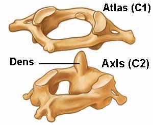 Atlas and Axis Vertebrae