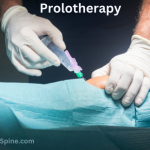 prolotherapy injection