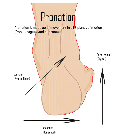 Overpronation of Foot Bone and Spine