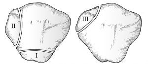 Classification of Bipartite Patella