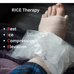 rice therapy is useful intial treatment in case of injury