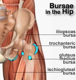 Trochanteric Hip Bursitis  Spine & Orthopedic Center