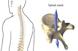 Vertebral Foramen and Canal Illustration