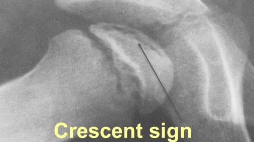 Crescent sign