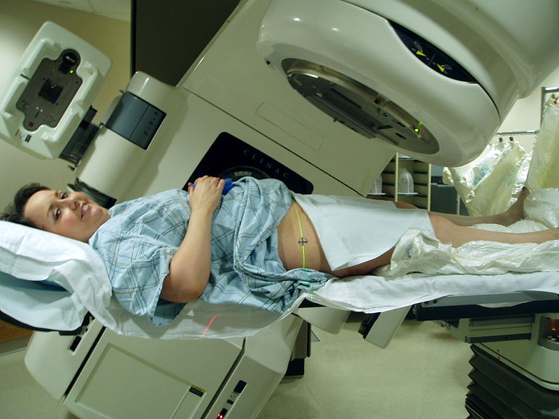 Radiation therapy to the pelvis