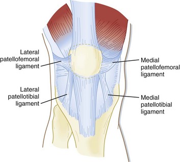 Patellofemoral joint stabilizers