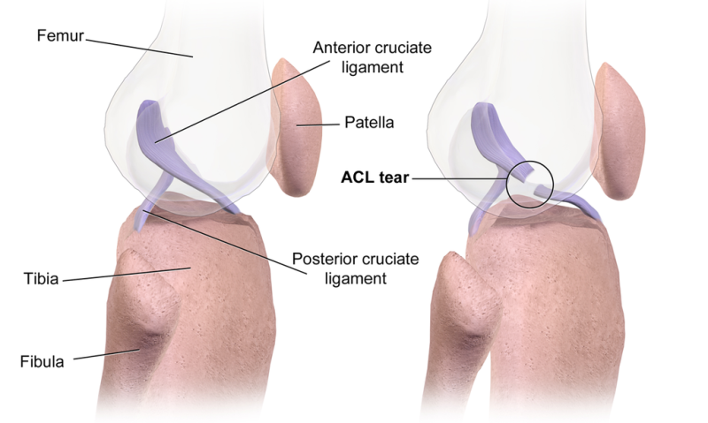 sulcus terminalis lateral femoral condyle