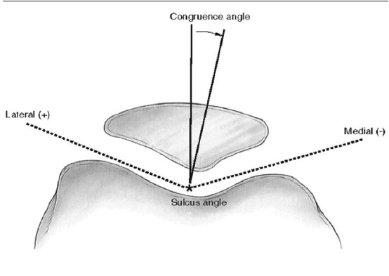 Sulcus angle