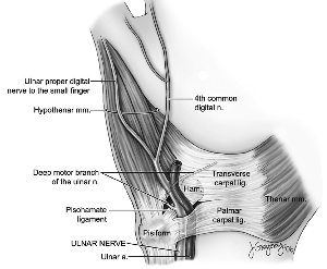 Guyon canal anatomy