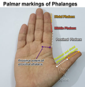 phalnx marking on fingers and hands palmar side